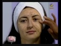 إزالة التجاعيد حول العين في 5 دقائق فقط!