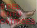 videos de Curacion de Urcera diabetica