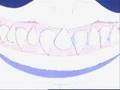 videos de Street Sharks
