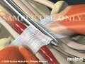 Carpal Tunnel