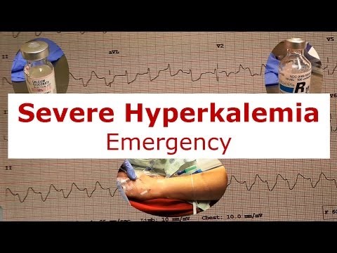 how to treat hyperkalemia