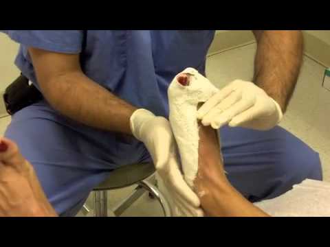 how to adjust orthotics