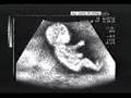��f�r bebek
