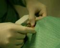 Organisatie LASIK-ingreep
