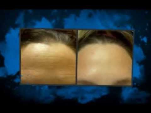 how to get rid of edema in feet