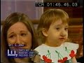 Removal of Hemangioma on Nose Part 2
