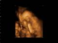 Our-Little-Girl-at-1