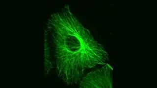 Tiny Mirror Improves Microscope Resolution for Studying Cells