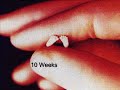 Unborn human development..