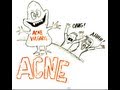 What is the Best Way to Treat Acne?