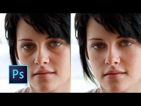 how to remove ojeras