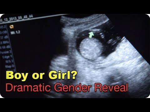 Boy or Girl? (Dramatic Gender Reveal)