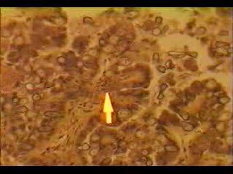 Eimeria stiedae-infected rabbit liver
