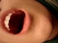 tonsils