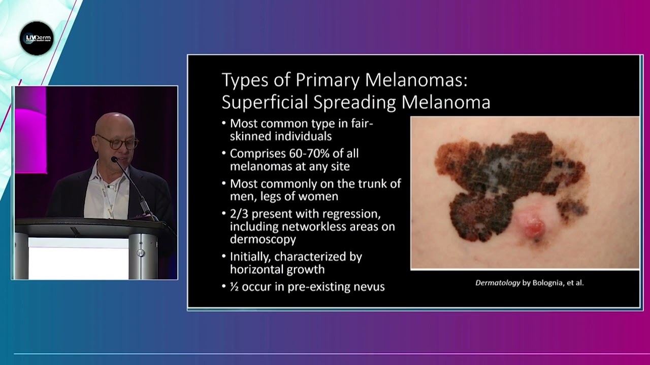 Advances in Melanoma
