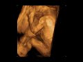 USG 2