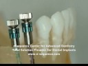 Full Service Dental Lab Specializing Implants and Esthetics Full Service Dental Lab Specializing Implants and Esthetics