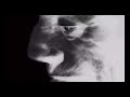 clip