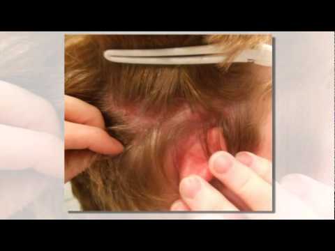 how to relieve an itchy scalp
