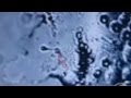 Microscopic Testicular Sperm Extraction (TESE)