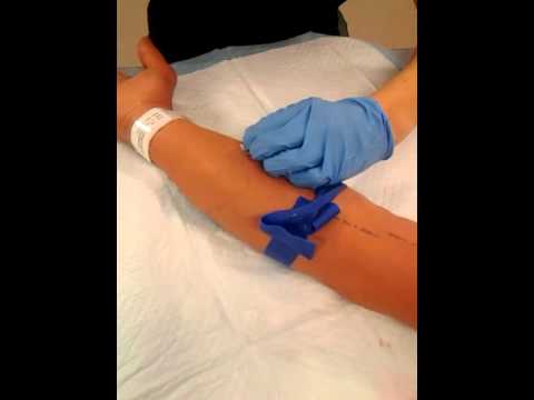 how to assess iv site