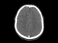 My Brain My Brain