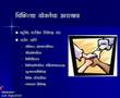 Colon Cancer