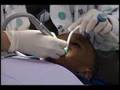 Delta Dental Foundation Video