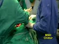 HEMANGIOMA