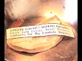 Radon - Surgeon General\