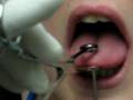 Tounge piercing