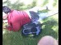 broken leg/fibula video 2