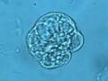 Plant Cell Motility and Laser Microsurgery of Cytoplasmic Strands