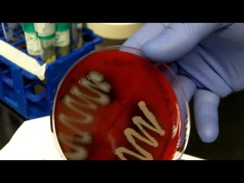 how to isolate bacteria from a mixed culture