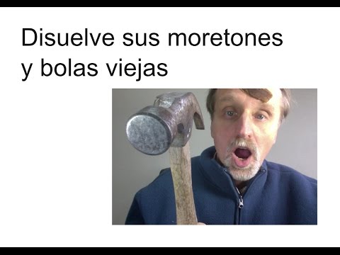 how to dissolve bruises