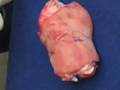 Sabis Chirurgie