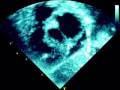 videos de ecocardiogramaJorgeRoblesSanchez