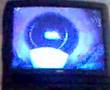 Part 2 Lasik Eye Operation