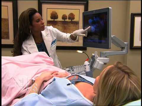 how to locate ovaries on ultrasound