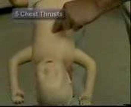 Infant Airway Obstruction