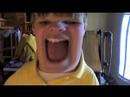 Thumbnail #1