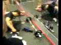 Gym-accident-Dumbbel