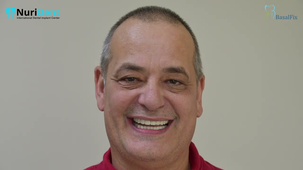 The new smile of Geert with BasalFix implants at NuriDent clinic Bulgaria