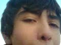 tapion herido