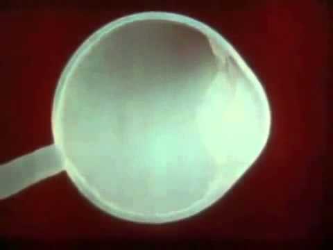 Видео Склера глаза - строение и функции, симптомы и болезни