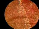 Sangre Vista desde Microscopio