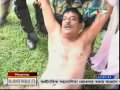 Injured opposition chief whip Zainul Abdin Farroque after an altercation with police in front of the parliament building on Wednesday morning. 6/7/2011 shazoltel.blogspot.com