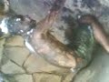 calourada de odonto sofrendo DIAMANTINA
