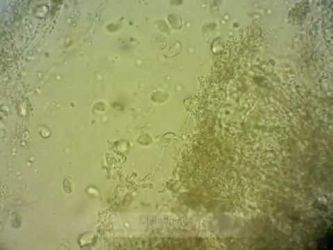 how to treat koi parasites