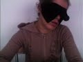Dermovision(Dermo Optical Perception) Dermovision